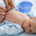 Curas del ombligo del recién nacido