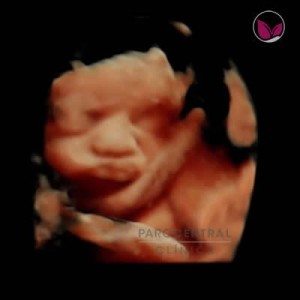 ecografia-5d-embarazada-semana23