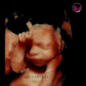 ecografia-5d-embarazada-semana24
