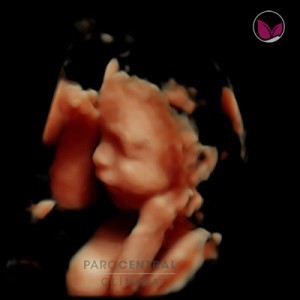 ecografia-5d-embarazada-semana25