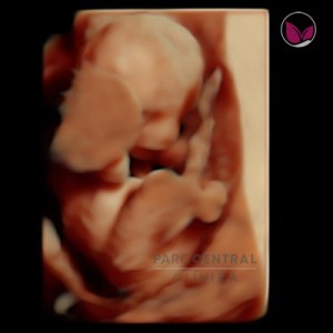 ecografia-5d-embarazada-semana16
