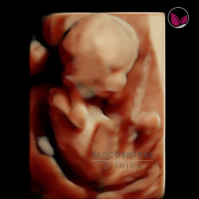 ecografia-5d-embarazada-semana17