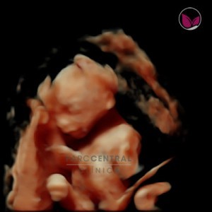 ecografia-5d-embarazada-semana20-foto2