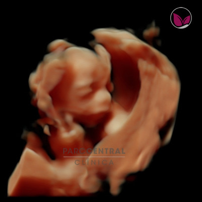 ecografia-5d-embarazada-semana20-foto3