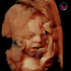 ecografia-5d-embarazada-semana26