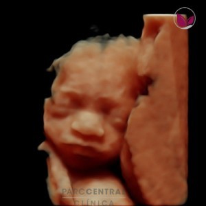ecografia-5d-embarazada-semana26