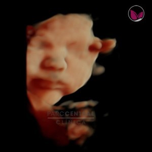 ecografia-5d-embarazada-semana33