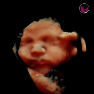 ecografia-5d-embarazada-semana35