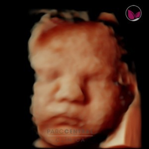 ecografia-5d-embarazada-semana37