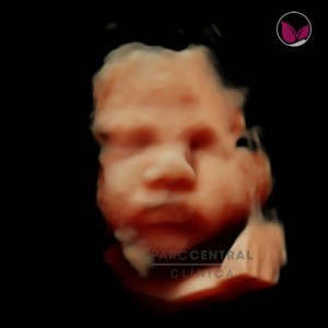 ecografia-5d-embarazada-semana38