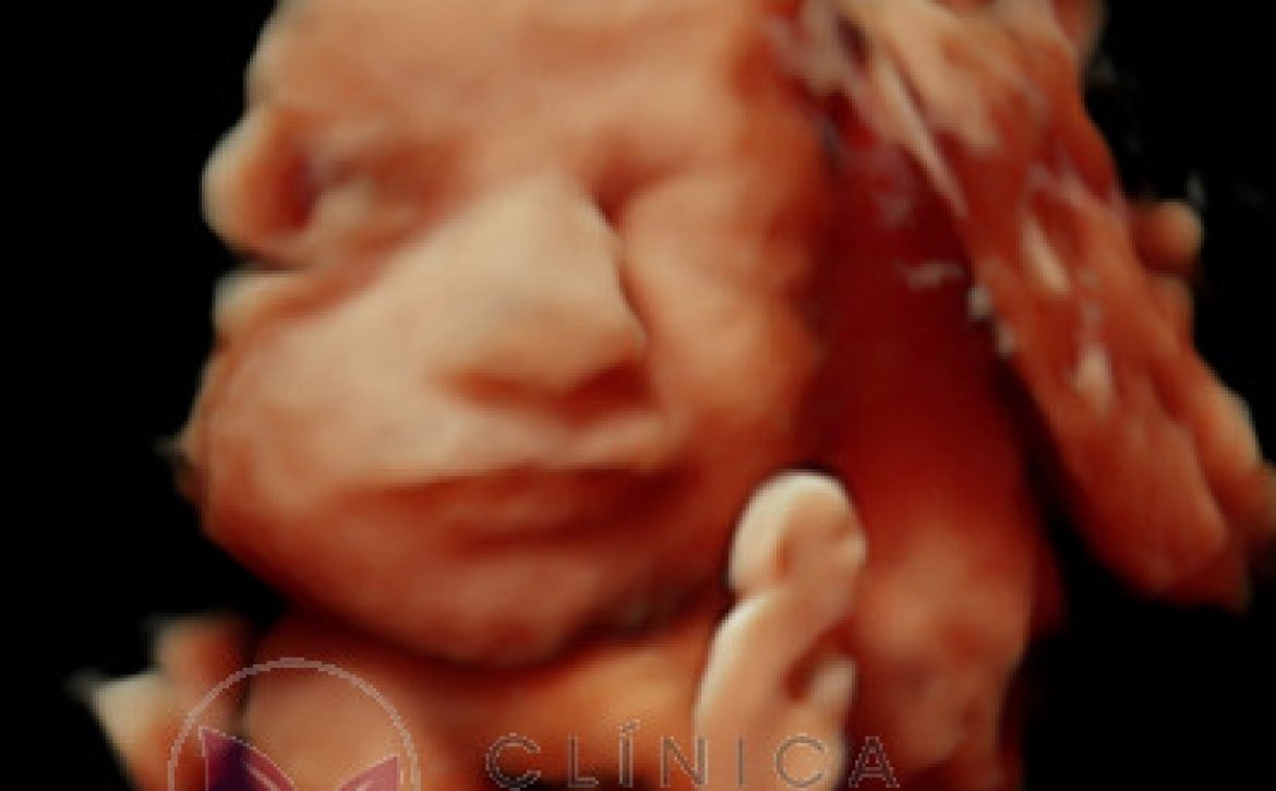 Ecografías 3D, la forma más realista de ver a tu bebé en el embarazo