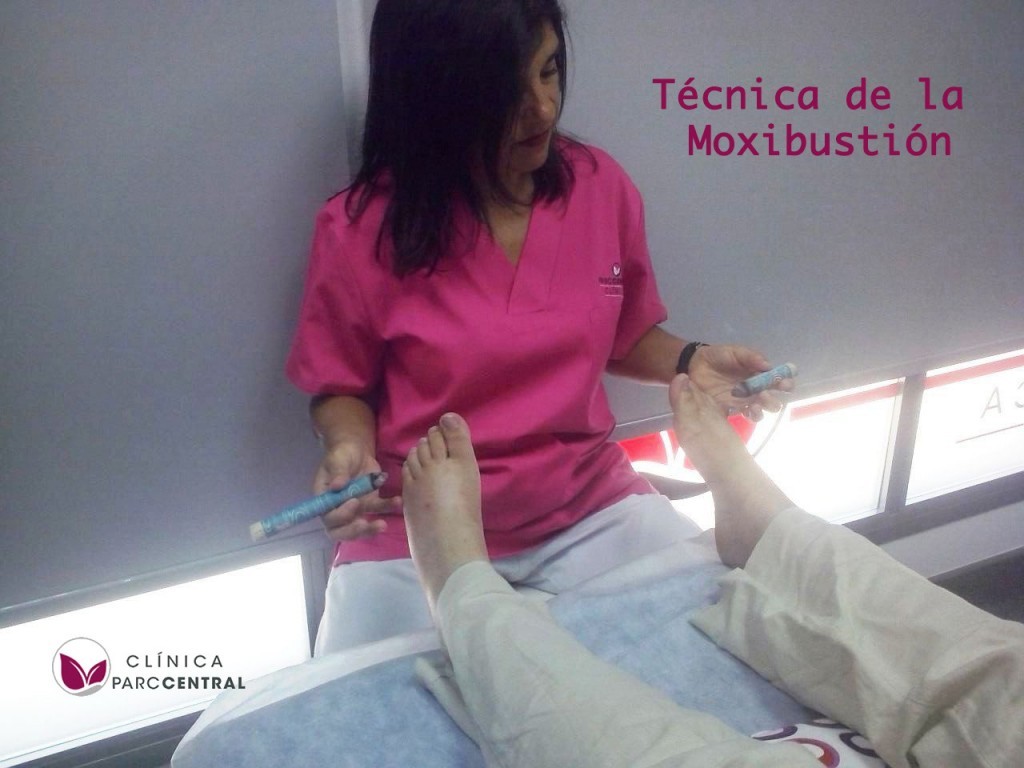 Técnica de la moxibustión
