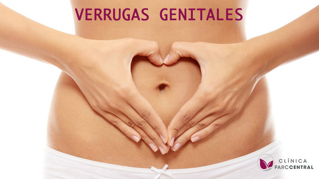 VERRUGAS GENITALES
