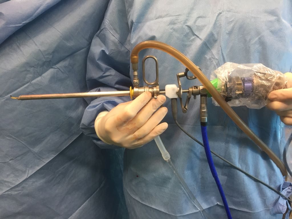 Conoce un poco mejor la Histeroscopia